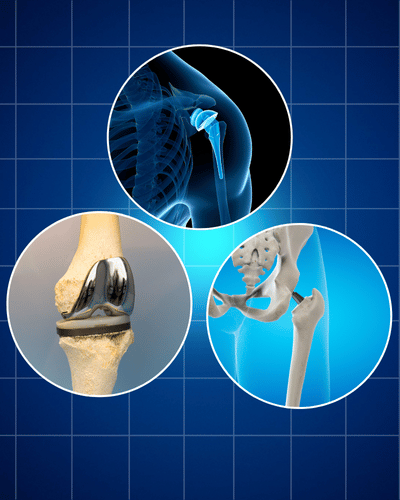 Joint replacement surgeries