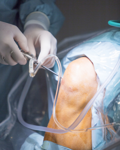 Knee Arthroscopy