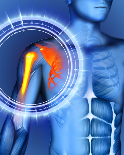 Shoulder Arthroscopy