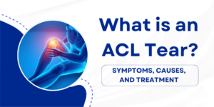 What is an ACL Tear