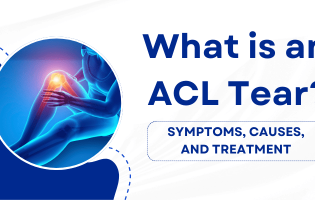 What is an ACL Tear