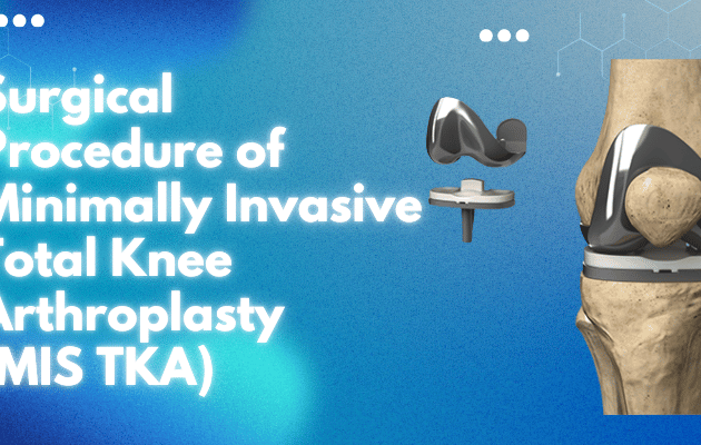 Surgical Procedure of Minimally Invasive Total Knee Arthroplasty