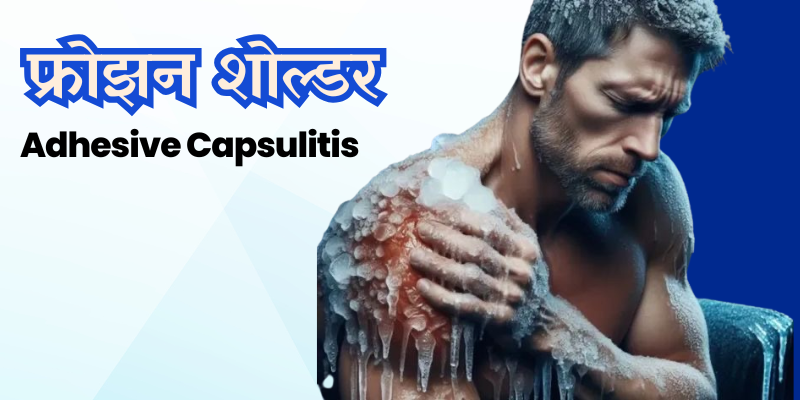 Adhesive Capsulitis